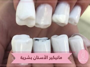 آخر موضة   تحويل الأظافر إلى أسنان بشرية!