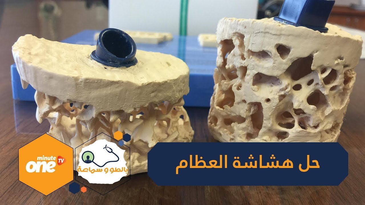 التحميل المسبق صورة