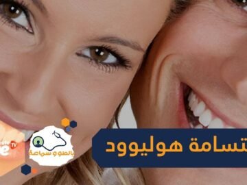 3 طرق بسيطة تمنحك ابتسامة هوليوود