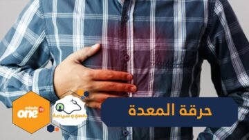 4 أسباب لحرقة المعدة.. و6 نصائح ذهبية