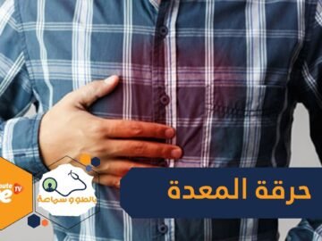4 أسباب لحرقة المعدة.. و6 نصائح ذهبية