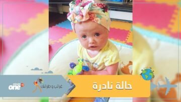 طفلة تمضي 4 ساعات يوميا في الاستحمام بسبب حالة نادرة