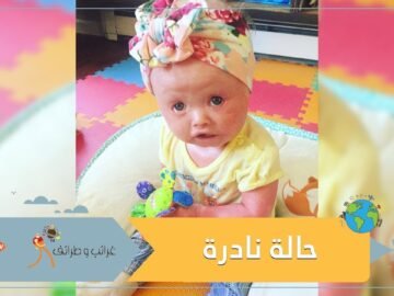 طفلة تمضي 4 ساعات يوميا في الاستحمام بسبب حالة نادرة