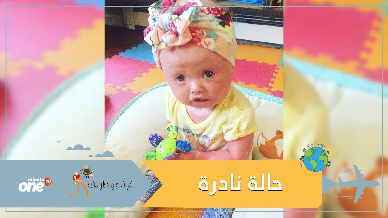 التحميل المسبق صورة