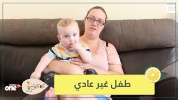 طفل جميل لكنه غير عادي   يعاني من 50 نوعا من الحساسية