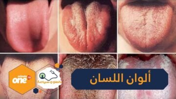 6 ألوان للسان   ماذا تعني؟