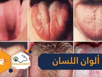 6 ألوان للسان   ماذا تعني؟