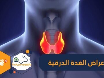 انتبه للغدة الدرقية   7 أمراض قد تصيبك بسبب اختلال التمثيل الغذائي