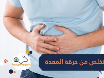 8 أغذية طبيعية تخلصك من حرقة المعدة.. تعرف عليها