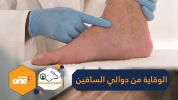 8 نصائح للوقاية من ظهور دوالي الساقين