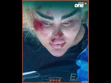 خاص: [ID: zRGGAlewZlg] Youtube Automatic