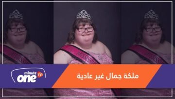 ملكة جمال وزنها 172 كيلوغراماً ومصابة بمتلازمة.. هذه قصتها