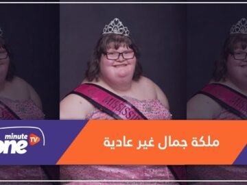 ملكة جمال وزنها 172 كيلوغراماً ومصابة بمتلازمة.. هذه قصتها
