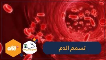 الإسهال والدوخة أبرز علامات تسمم الدم.. فما هي أعراضه الأخرى؟