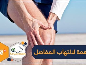 كركم وسمك.. أطعمة تقلل من التهابات المفاصل