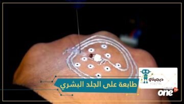 لأول مرة.. الطباعة على جسم الإنسان بتقنية ثلاثية الأبعاد