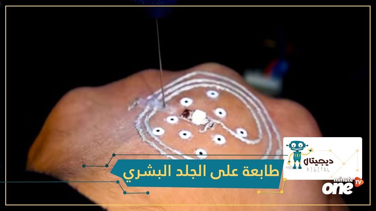 التحميل المسبق صورة