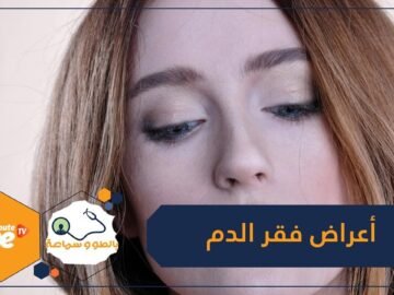 تعرف على أعراض فقر الدم.. أهمها شحوب الجلد وضيق فى التنفس