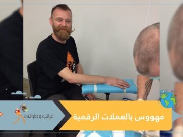 مهووس بالعملات الرقمية.. خبأ البيتكوين تحت جلده خوفا من القرصنة!