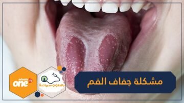 ما سبب جفاف الفم في الليل وكيف تتغلب عليه؟