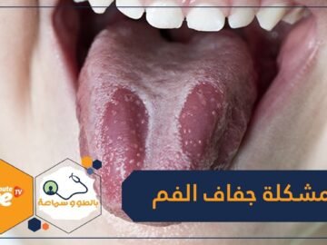 ما سبب جفاف الفم في الليل وكيف تتغلب عليه؟