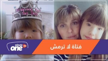 حالة نادرة جعلت هذه الفتاة لا تستطيع أن ترمش