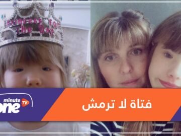 حالة نادرة جعلت هذه الفتاة لا تستطيع أن ترمش