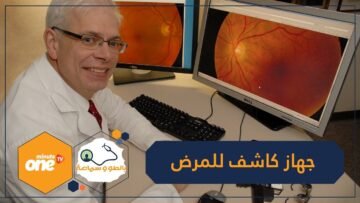 أول جهاز ذكاء اصطناعي يكشف عن المرض دون مساعدة طبيب