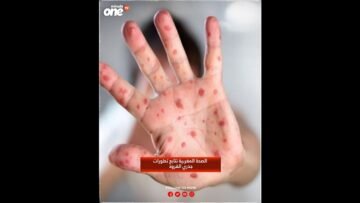 خاص: [ID: wd4u7Ifl0x0] Youtube Automatic