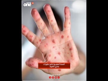 خاص: [ID: wd4u7Ifl0x0] Youtube Automatic