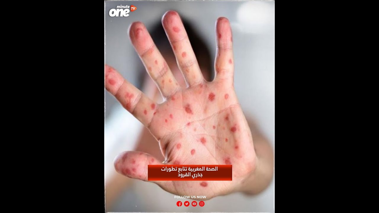 التحميل المسبق صورة