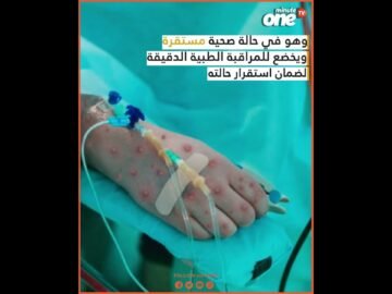 خاص: [ID: HUB79eGERYk] Youtube Automatic