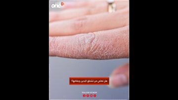 خاص: [ID: fu0s6Nqkezw] Youtube Automatic