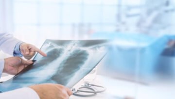 tbl_articles_article_36612_808345d4002-1e3d-4d0f-a00a-321e7a49956d