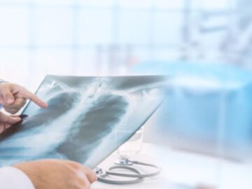 tbl_articles_article_36612_808345d4002-1e3d-4d0f-a00a-321e7a49956d