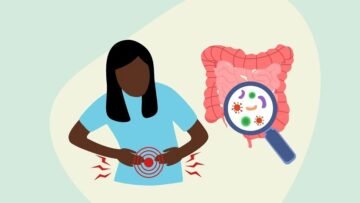 Food-Poisoning-Treatment-8-Effective-Home-Herb.-naturopathy-by-food